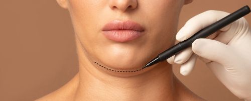 Mentoplastia o cirug&iacute;a del ment&oacute;n (con pr&oacute;tesis)