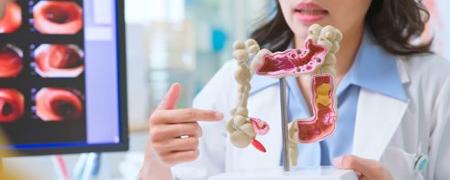 Gastroscopia con polipectom&iacute;a y anatom&iacute;a patol&oacute;gica 