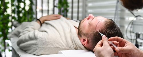 Microinjerto capilar FUE (entradas y coronilla)