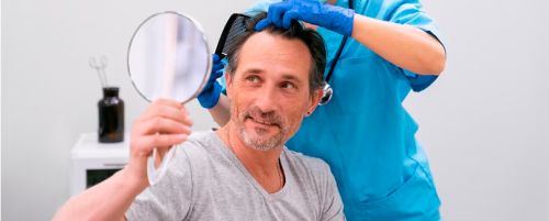 Tratamiento capilar con plasma (PRP-Plasma Rico en Plaquetas)