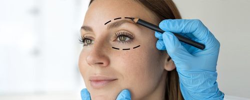Blefaroplastia completa (cirugía de los párpados)