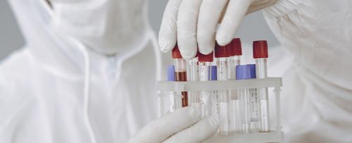 An&aacute;lisis otros marcadores tumorales