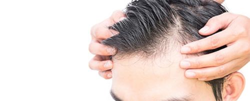 Microinjerto capilar ARTAS (entradas y coronilla)