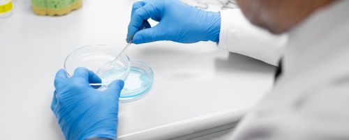 Conservación de células madre - Servicio First