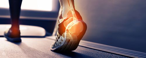 Estudio biomecánico de la marcha o de la pisada