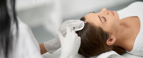 Tratamiento de mesoterapia capilar con Svenson