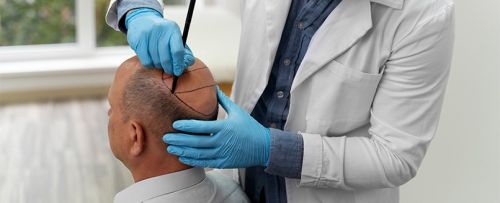 Microinjerto Premium con Svenson