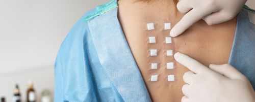 Prueba epicutánea (Test del parche)