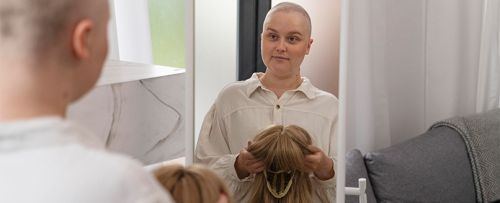 Prótesis capilar oncológica con Svenson