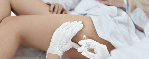 Mesoterapia corporal