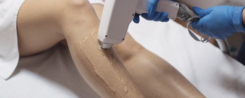 Depilación - Pack de 5 sesiones en zona piernas completas, ingles y axilas