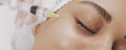 Tratamiento de ojeras con ácido hialurónico