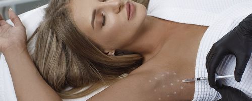 Botox para la hiperhidrosis