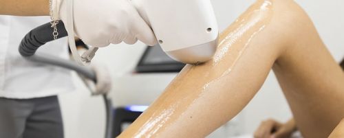 Depilación láser 5 sesiones