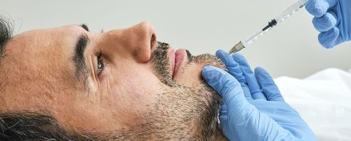 Marcación mandibular con ácido hialurónico 3 viales