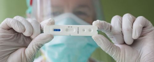 Análisis Ag Covid-19