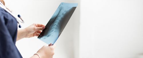 Radiografía de la columna cervical (una proyección)