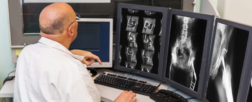 Radiografía del muslo (fémur) (proyecciones sucesivas)