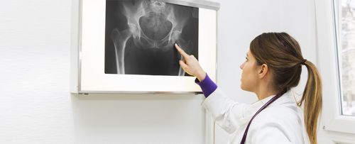 Radiografía de cadera (proyecciones sucesivas)