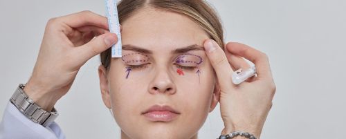 Blefaroplastia superior (cirug&iacute;a de los p&aacute;rpados superiores)