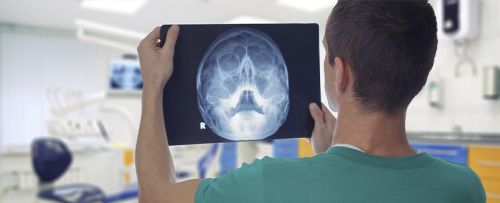 Radiografía de cráneo (proyecciones sucesivas)