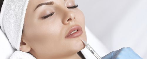 Perfilado de labios hialurónico